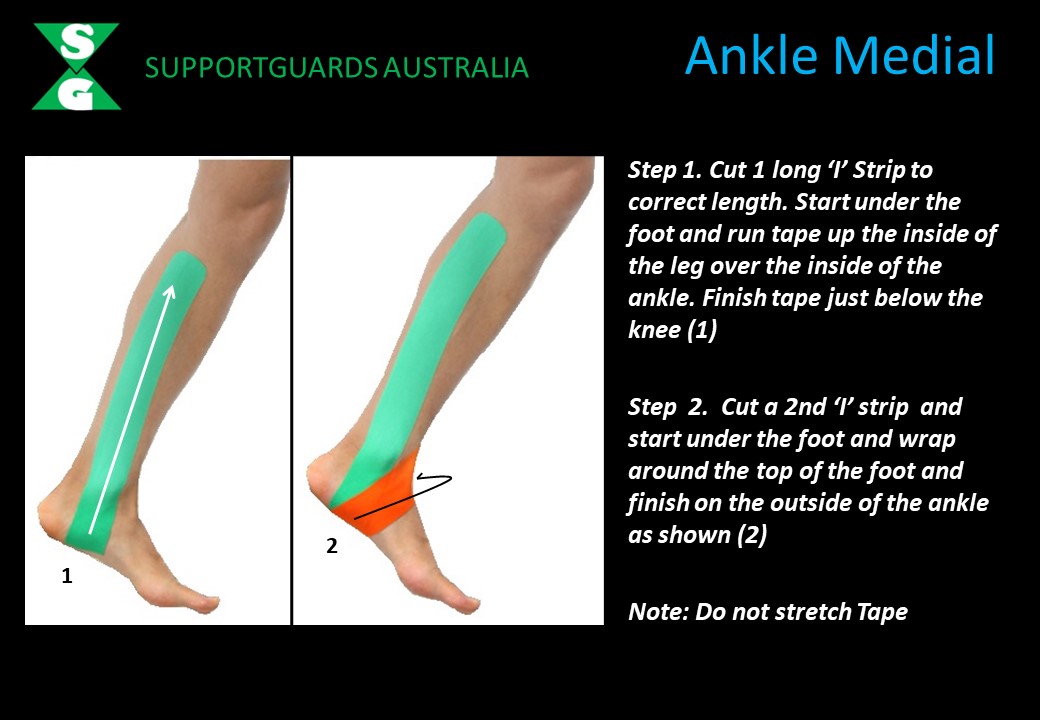 Ankle Medial KT 1